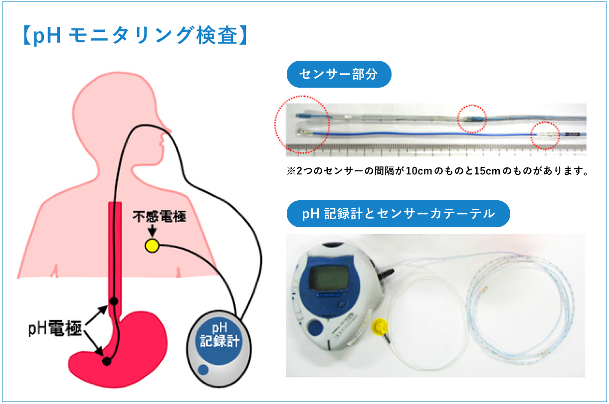 pHモニタリング検査