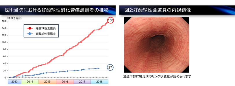 好酸球性消化管疾患の図